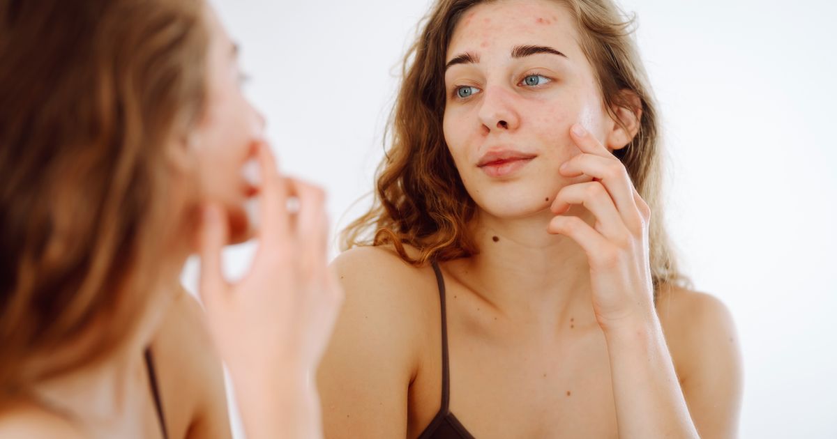 co-pomaha-na-suchou-plet (4)